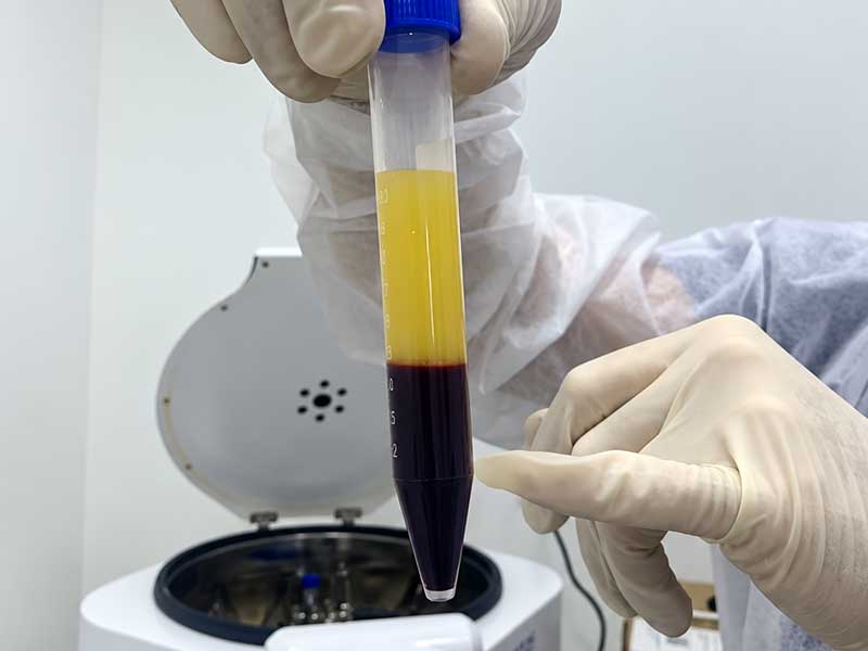 Medicina Regenerativa na DTM