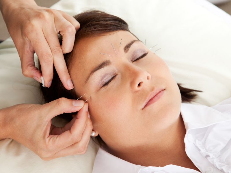 acupuntura pode ajudar em tratamentos dentários
